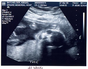 ultrasound-by-abbybatchelder.jpg
