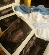 how-to-drink-enough-water-for-your-ultrasound.jpg