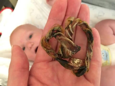 Why I Chose Placenta Encapsulation After The Birth Of My Baby (Benefits Of Eating Placenta)