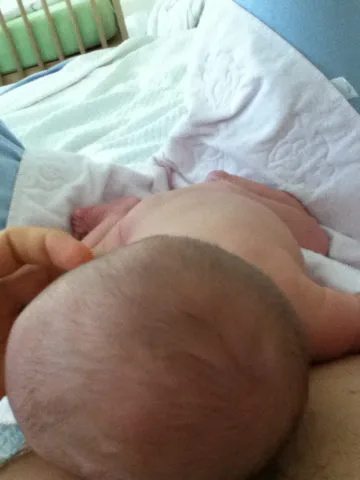 diaper-rash