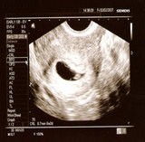 starting-a-baby-blog-best-way-to-record-pregnancy-journal-ultrasound-photos.jpg