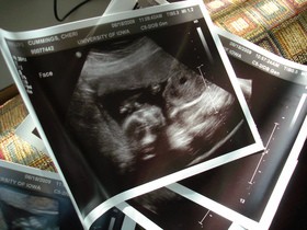 ultrasound-pictures-by-Stephen-Cummings.jpg